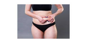 How much does liposuction cost? Dallas plastic surgeon Bradley Hubbard MD